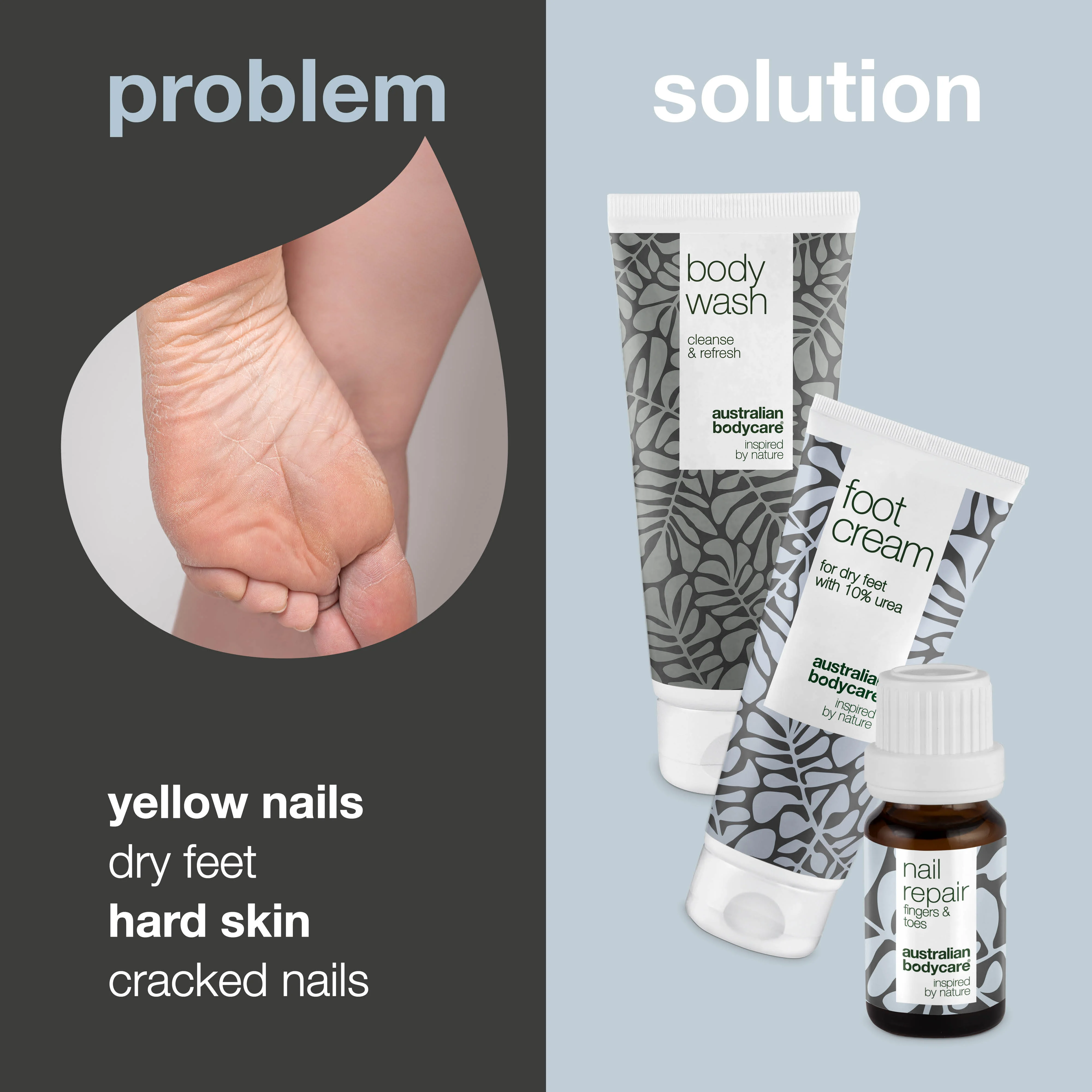 Footcare kit — 3 products for daily foot care of dry feet and yellow nails - Image 2