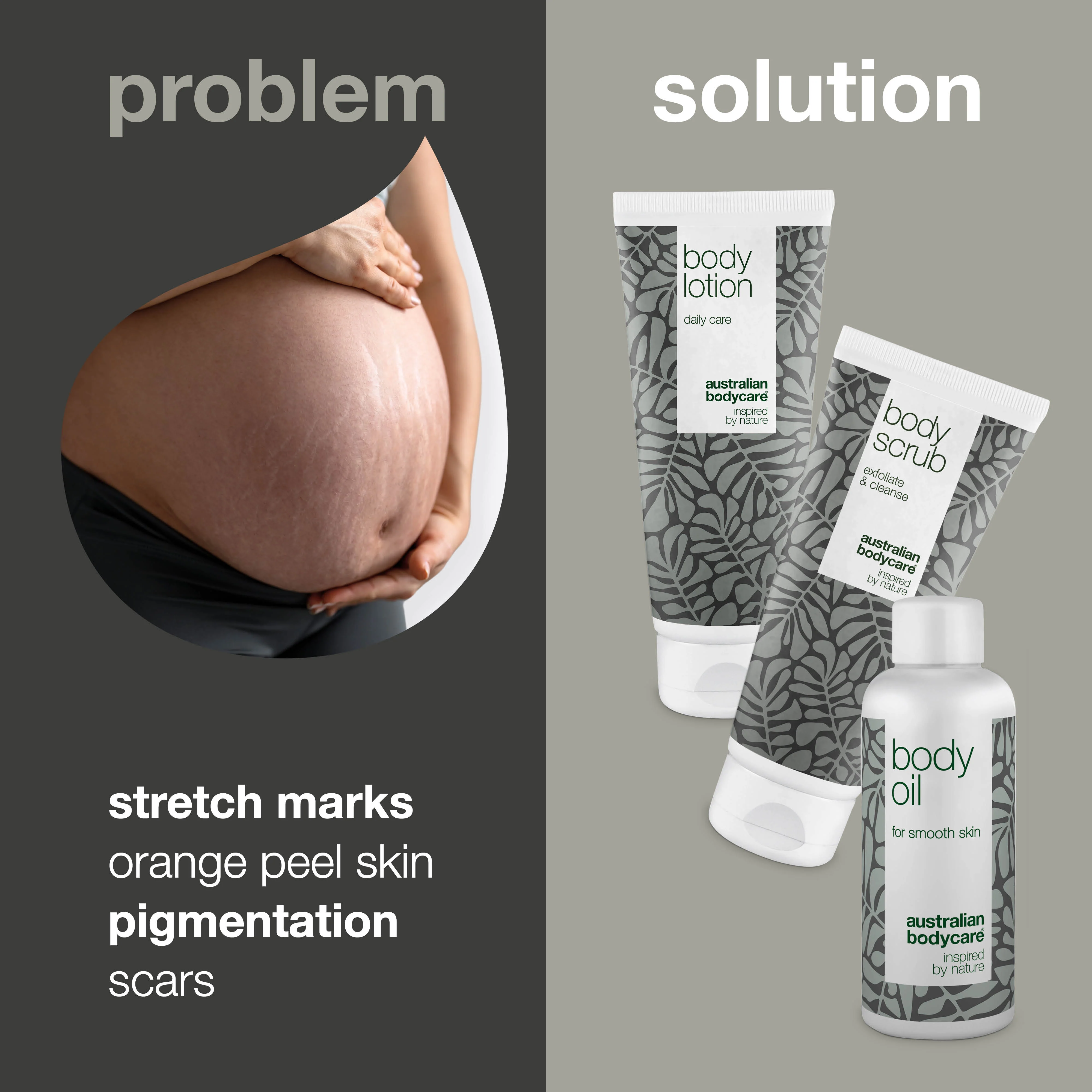 3–Pack to reduce stretch marks — 3 products to reduce the visibility of stretch marks and scars - Image 2