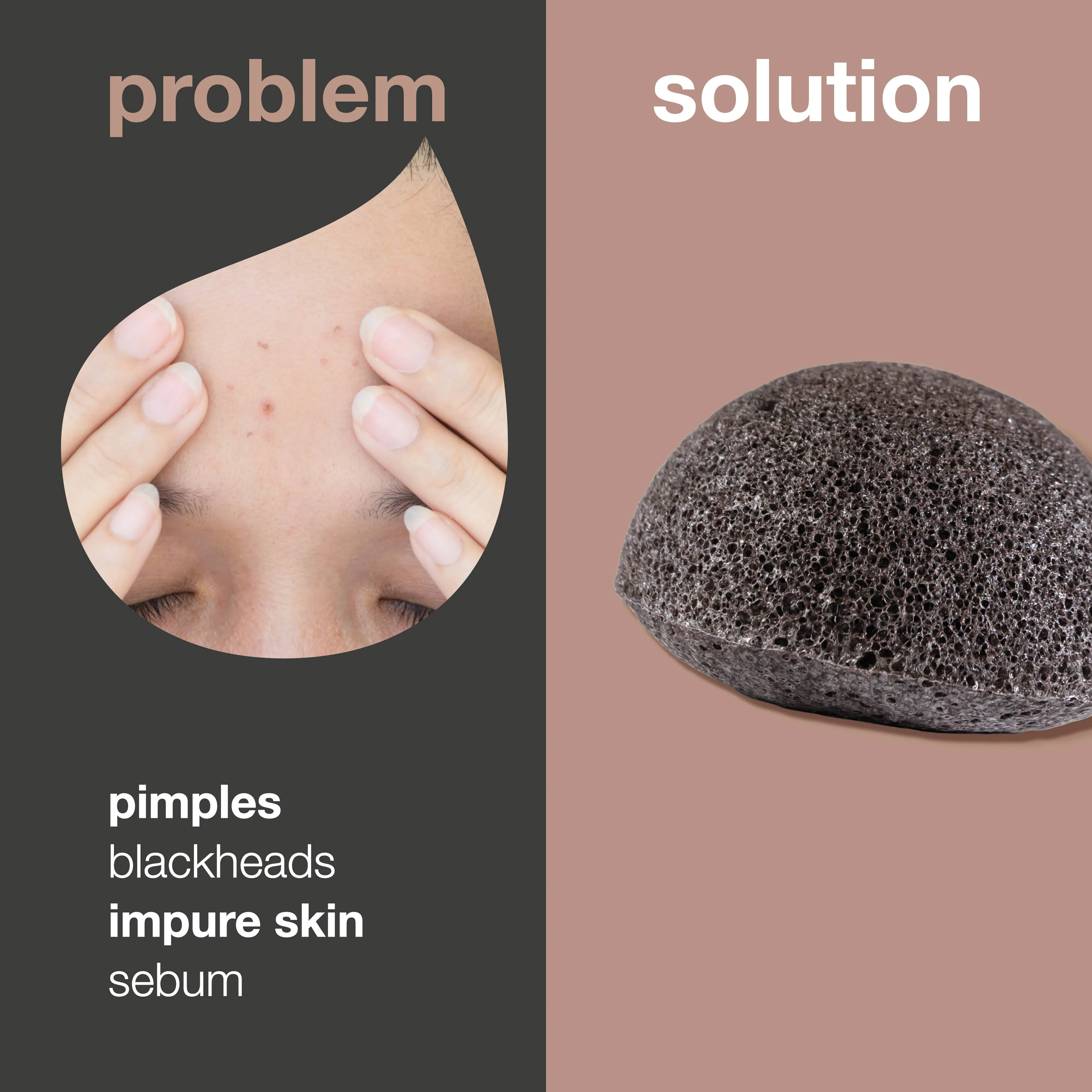 Konjac sponge for skin blemishes — Konjac Sponge for natural exfoliation of pimples and blackheads - Image 2