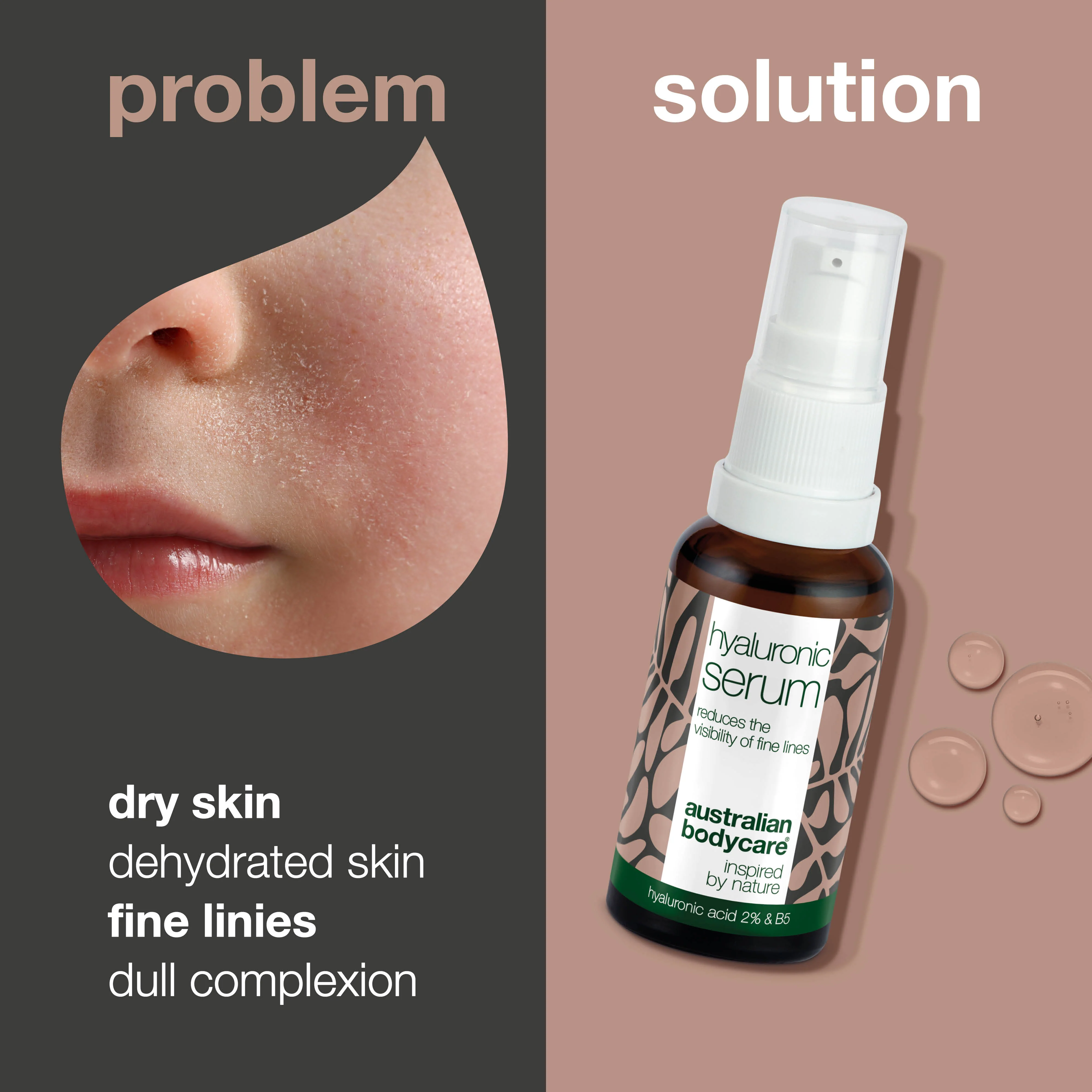 Hyaluronic Acid Serum 2% – Intense Moisture with B5 — Hyaluronic Acid Serum 2% deeply hydrates, reduces fine lines, and leaves skin soft and smooth. Perfect for all skin types. - Image 2