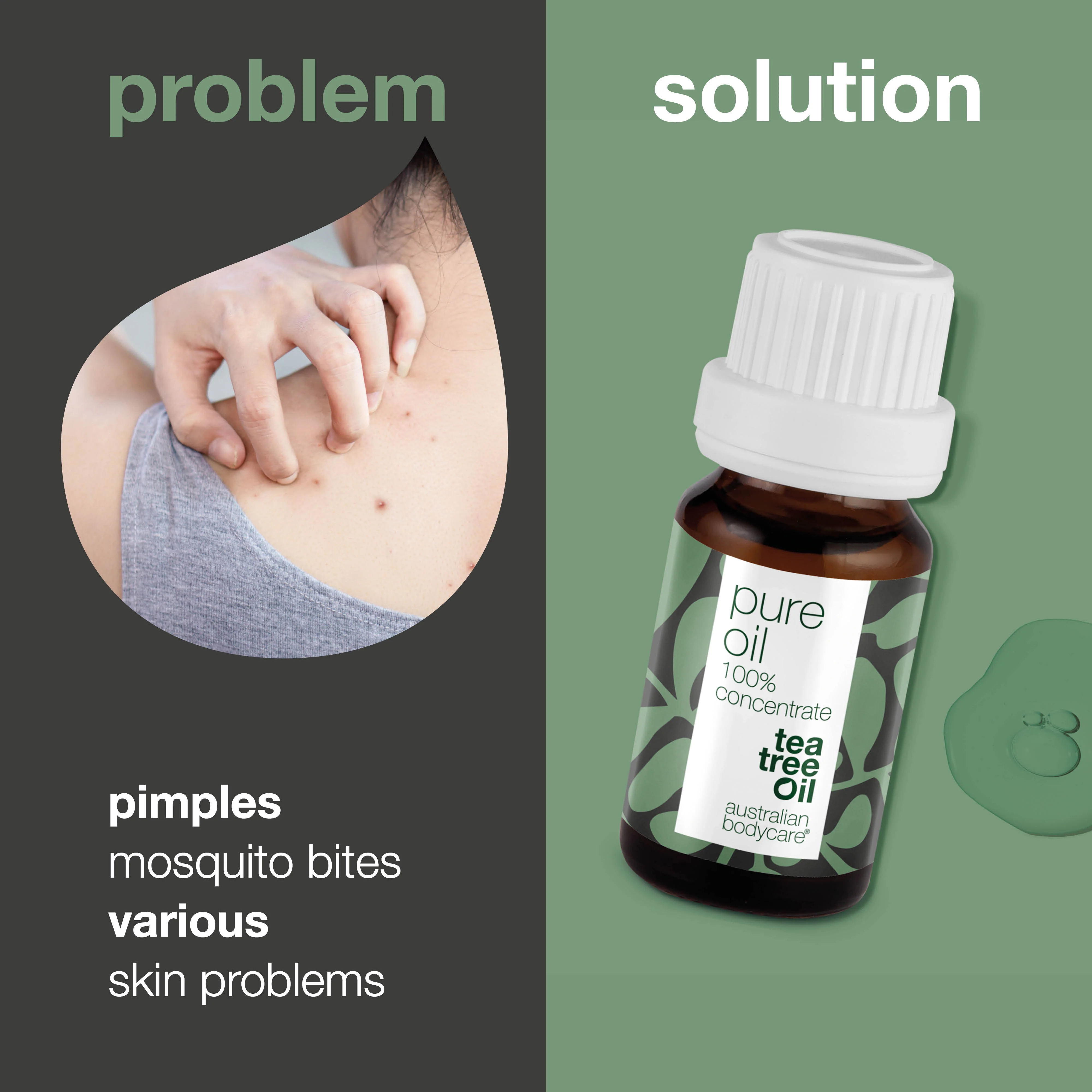 Pure Tea Tree Oil for skin problems — 100% natural and concentrated Tea Tree Oil from Australia - Image 2