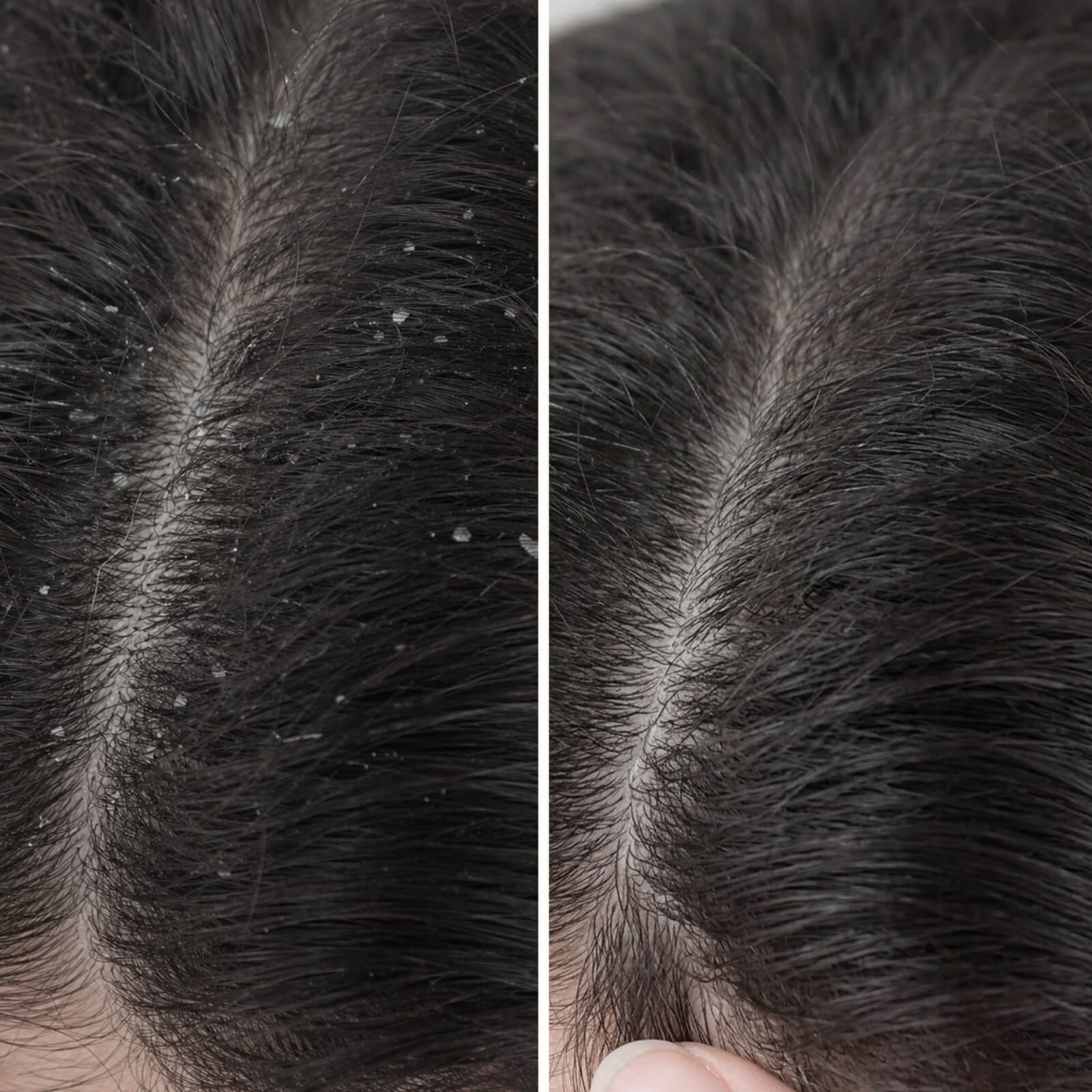 Salicylic Acid Conditioner for Dandruff & Itchy Scalp — Salicylic Acid Conditioner against dandruff and itchiness. Hydrates the scalp and strengthens hair. Effective care with Salicylic Acid. - Image 9