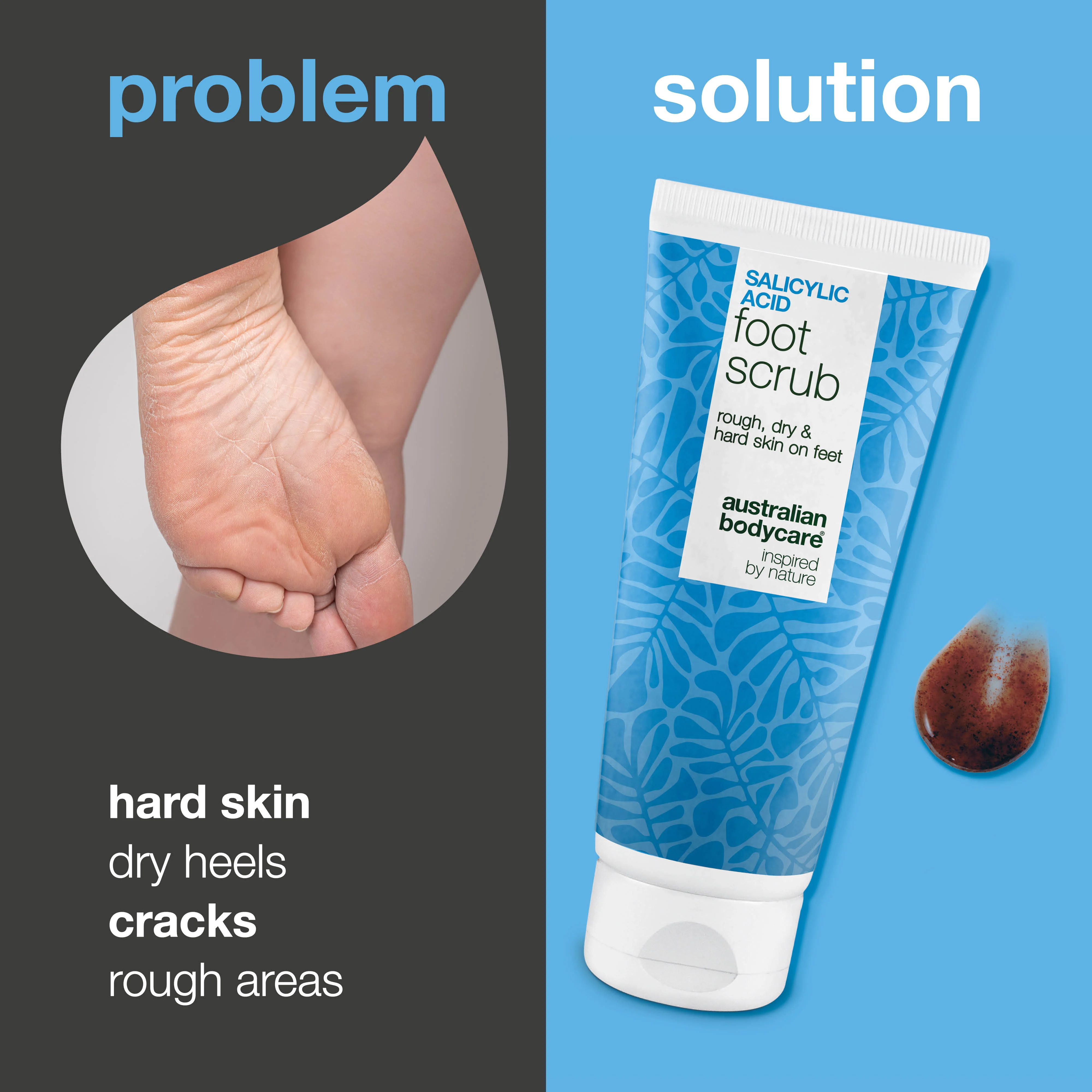 Salicylic Acid Foot Scrub – removes hard, dry and rough skin — Foot Scrub with Salicylic Acid treats rough, cracked heels. Deeply exfoliates and hydrates for soft, refreshed and smooth feet. - Image 2