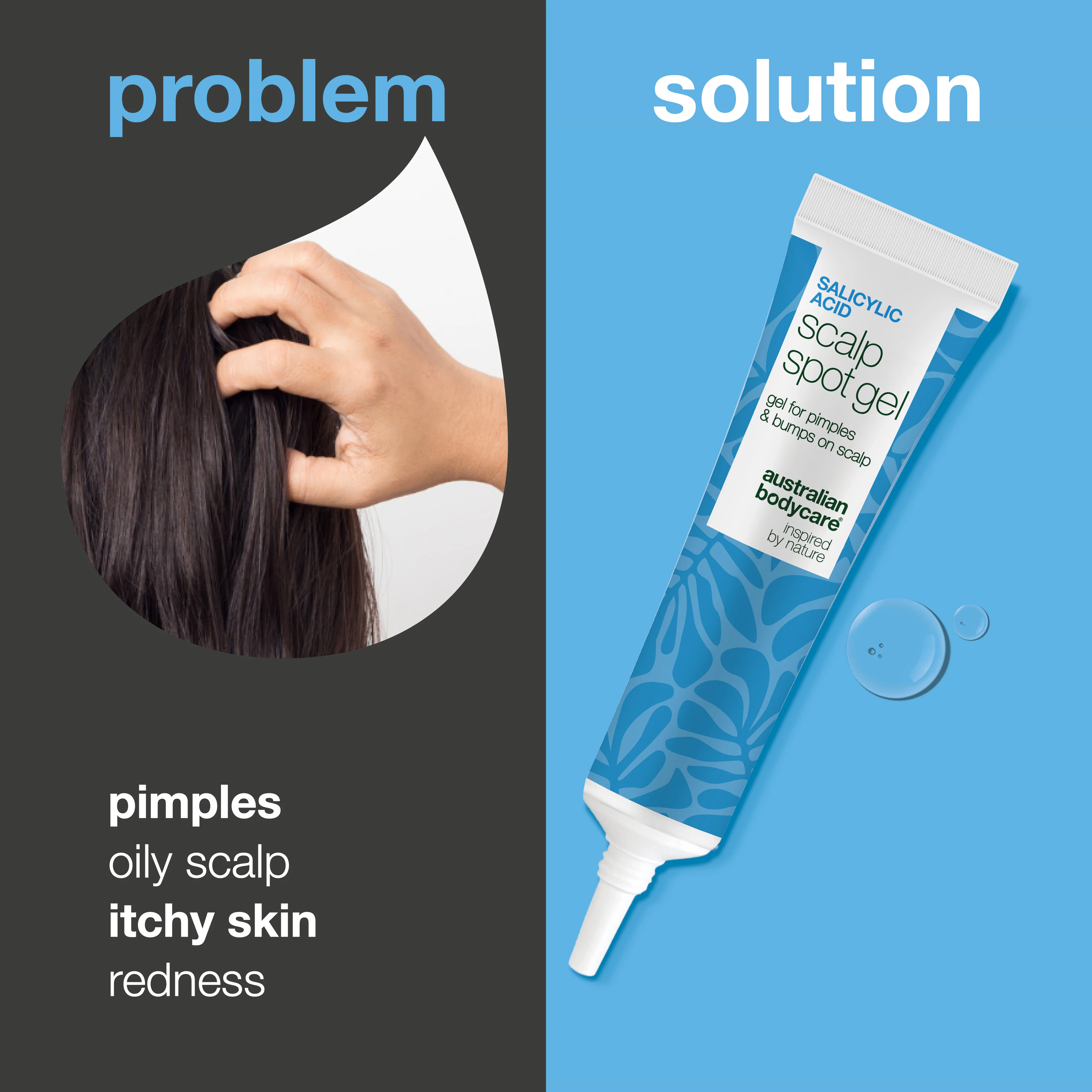 Salicylic Acid Gel for Pimples on Scalp & Itchy Bumps — How to get rid of pimples on your scalp? Use our Salicylic Acid Gel to exfoliate pores and soothe itchy, red, and painful spots instantly. - Image 2