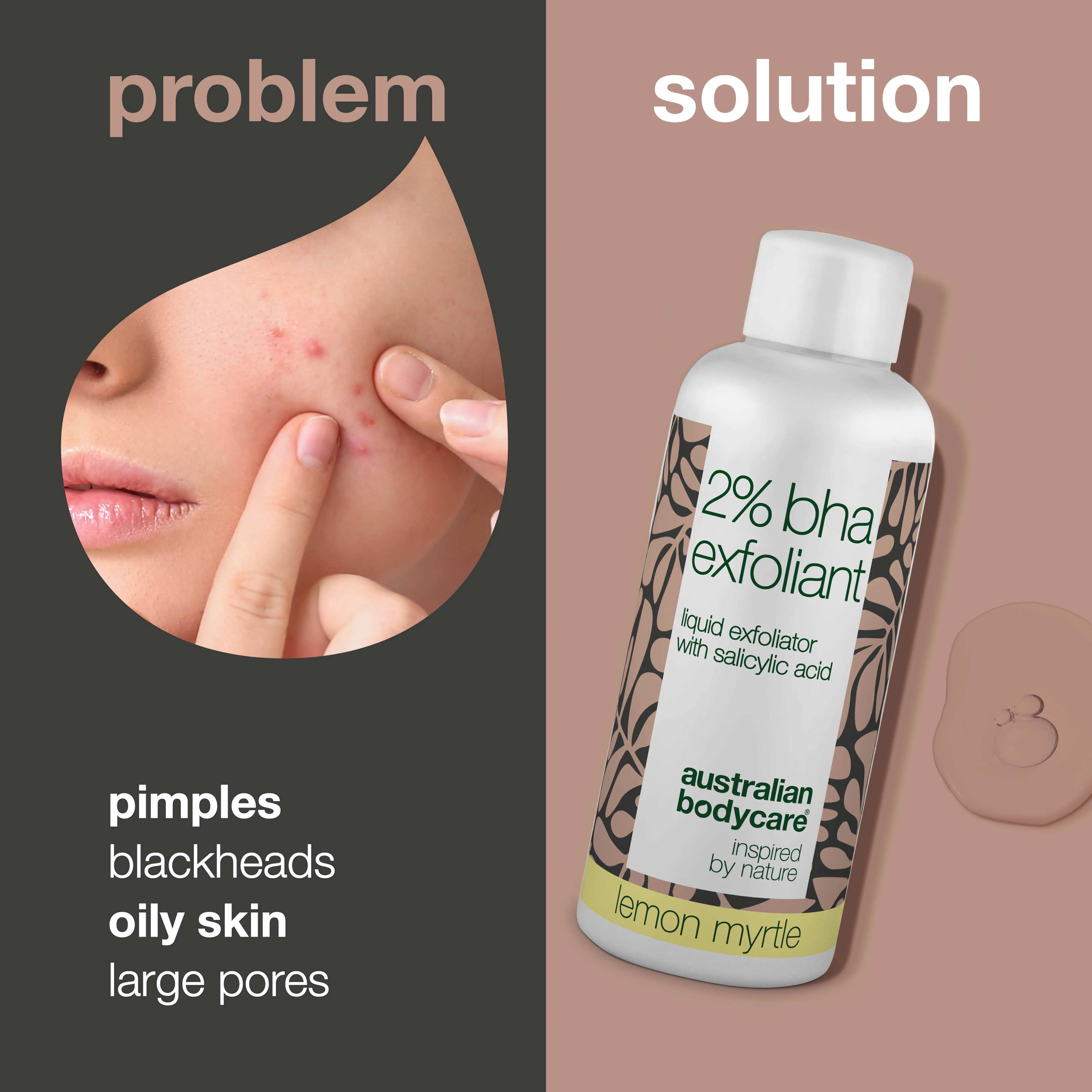 T-zone Peeling 2% BHA – Clears pores, blackheads & oily skin — T-zone Peeling with 2% BHA exfoliates, removes dead skin cells & fights breakouts. Say goodbye to blemishes & get clearer skin. - Image 2