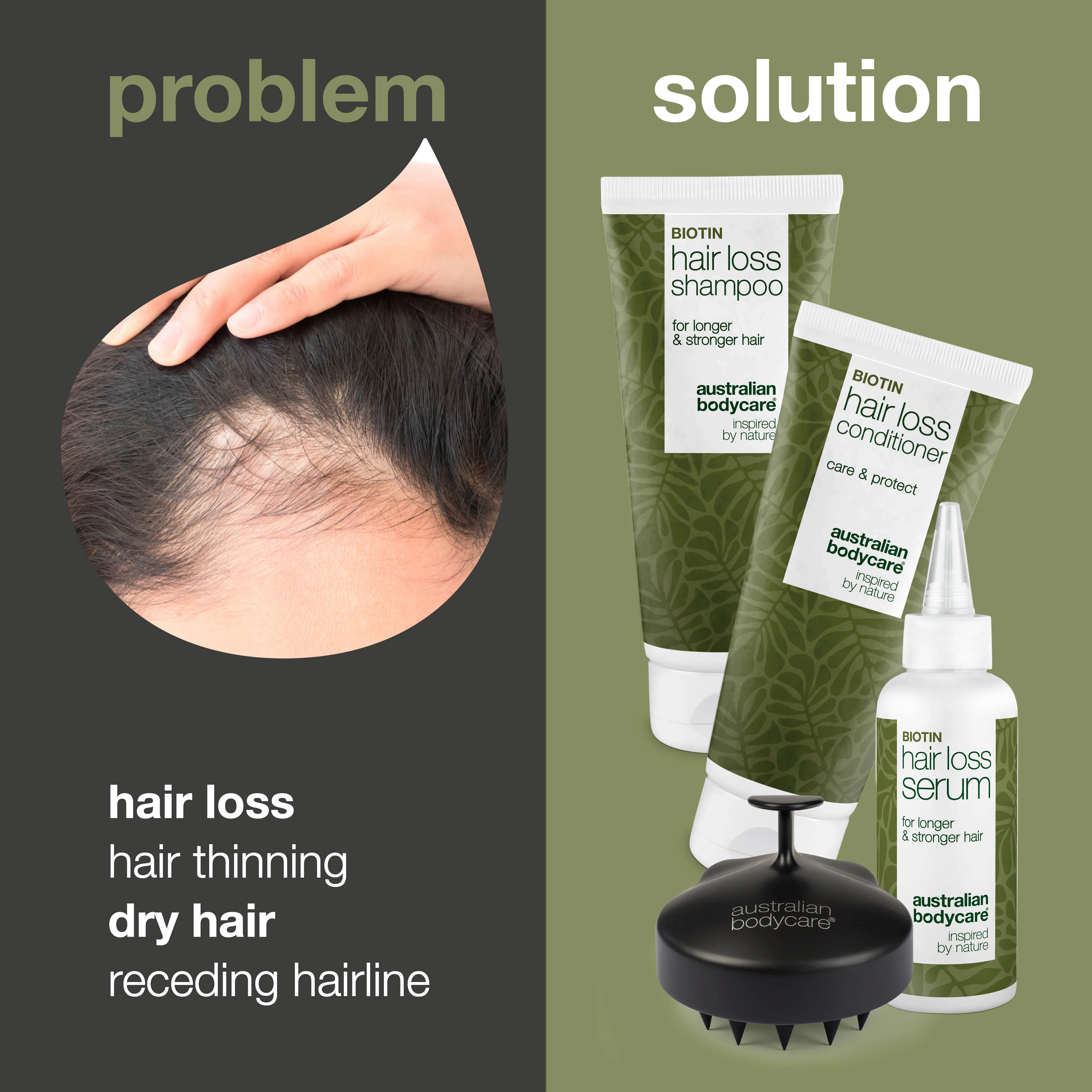 The ultimate hair loss kit — 4 products for hair loss & hair thinning - Image 2